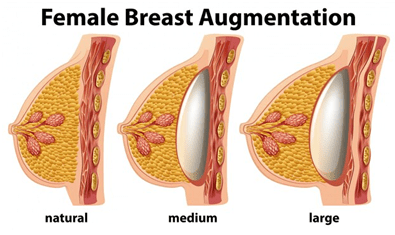 female breast